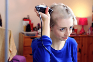 Shaving My Hair Off (2016) - TrichJournal - YouTube